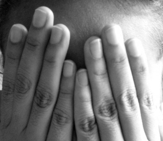 Todo lo que debes saber sobre el acné acné