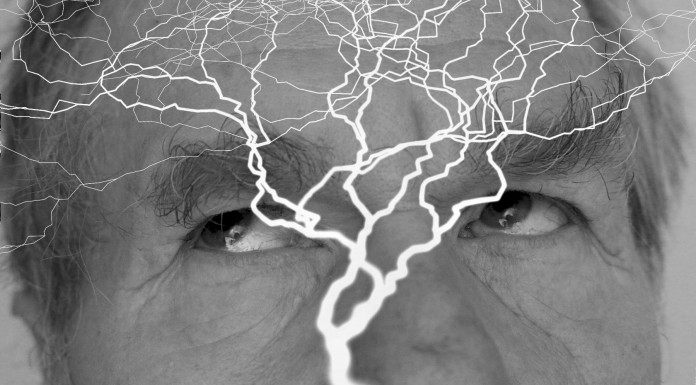 3 maneras saludables de prevenir dolores de cabeza 3 maneras saludables de prevenir dolores de cabeza