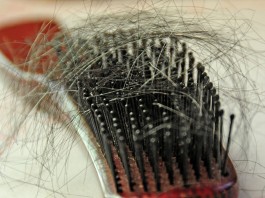 Principales causas de la caída del cabello (I) caída del pelo