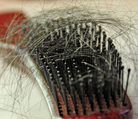 Principales causas de la caída del cabello (I) caída del pelo