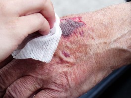 6 errores de primeros auxilios que son más peligrosos de lo que parece (I) 7 errores de primeros auxilios que son más peligrosos de lo que parece