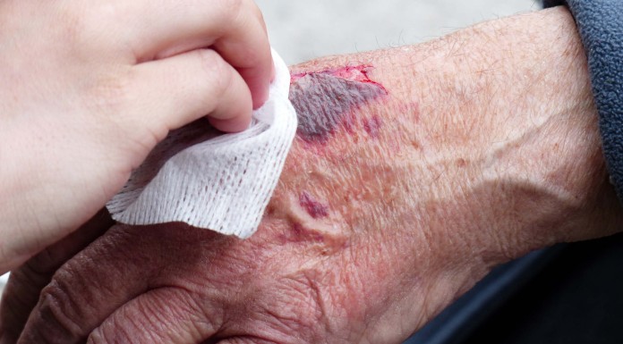 6 errores de primeros auxilios que son más peligrosos de lo que parece (I) 7 errores de primeros auxilios que son más peligrosos de lo que parece