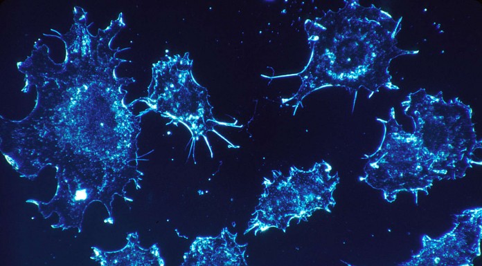 8 señales que pueden ser síntomas de algún cáncer 8 señales que pueden ser síntomas de algún cáncer