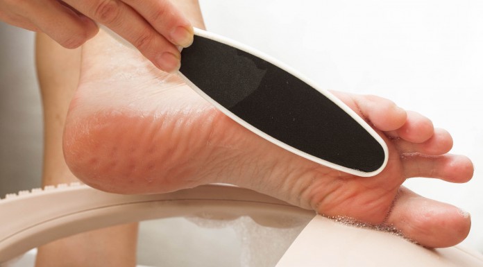 10 remedios caseros para los callos de los pies (III) 10 remedios caseros para los callos de los pies (III)