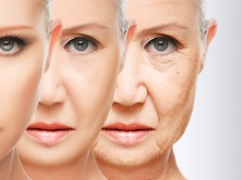 7 cosas sorprendentes que causan arrugas