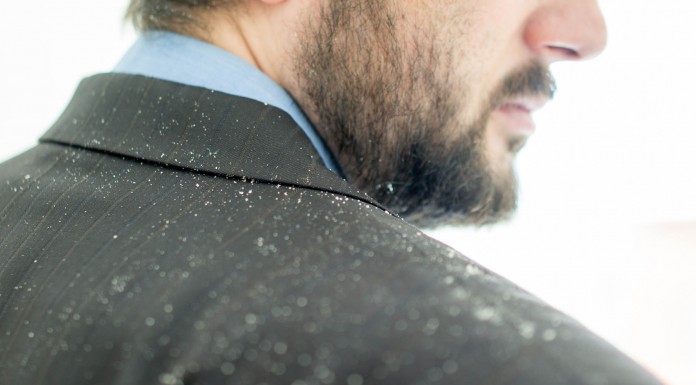 7 alimentos que te ayudarán a combatir la caspa 7 alimentos que te ayudará para combatir la caspa