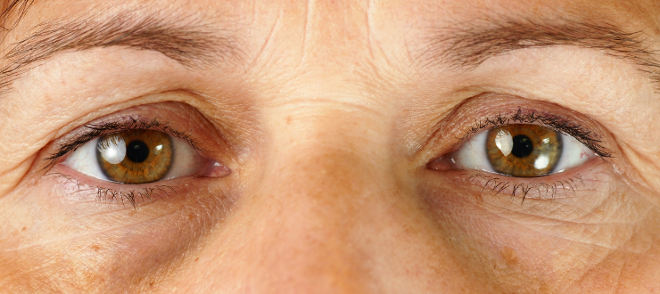bigstock-Very-Tired-Eyes-35898931