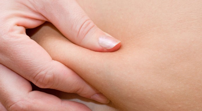 5 consejos para prevenir la retención de líquidos 5 consejos para prevenir la retención de líquidos