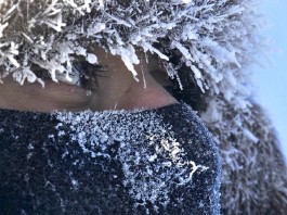 7 consejos para aliviar el picor y la sequedad de la piel en invierno 7 consejos para aliviar el picor y la sequedad de la piel en invierno