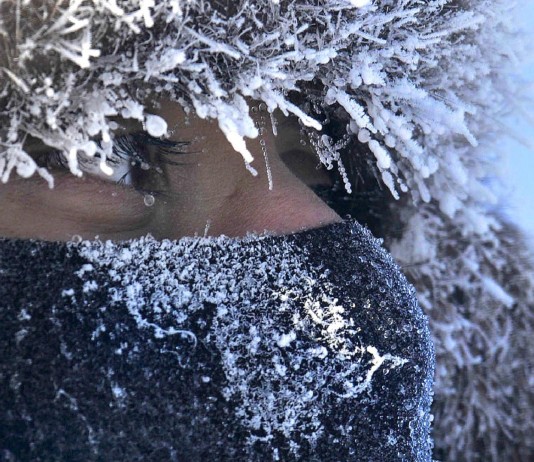 7 consejos para aliviar el picor y la sequedad de la piel en invierno 7 consejos para aliviar el picor y la sequedad de la piel en invierno