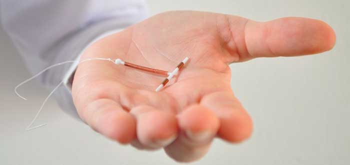 Los 8 métodos anticonceptivos femeninos que debes conocer 8