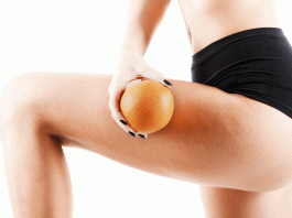 Como eliminar la celulitis: 5 remedios caseros Como eliminar la celulitis: 5 remedios caseros