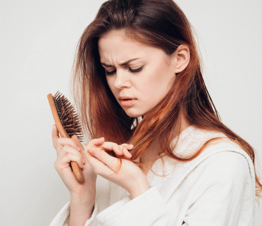 10 Remedios para la caída del cabello: consigue un pelo irresistible Remedios para la caida del cabello