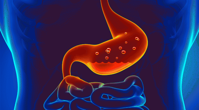 9 Remedios para la gastritis: te ayudamos a combatirla Remedios para la gastritis