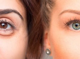 5 Consejos infalibles para reducir bolsas y ojeras: ¡luce una mirada joven! 5 Consejos infalibles para reducir bolsas y ojeras