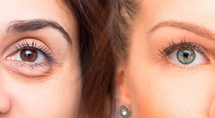 5 Consejos infalibles para reducir bolsas y ojeras
