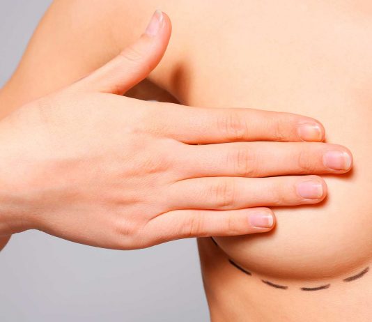 Tratamientos para el aumento y la elevación de pecho femenino. ¡Descúbrelos! Tratamiento de pecho