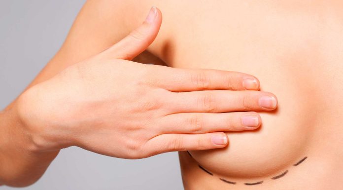 Tratamientos para el aumento y la elevación de pecho femenino. ¡Descúbrelos! Tratamiento de pecho