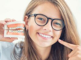 ¿Cuándo debes plantearte la ortodoncia? La importancia de la salud dental cuando planearte la ortodoncia