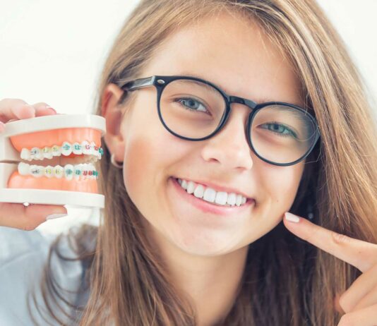 ¿Cuándo debes plantearte la ortodoncia? La importancia de la salud dental cuando planearte la ortodoncia