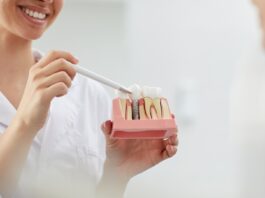 Lo que ocurre tras ponerse implantes dentales: qué es normal y qué no Lo que ocurre tras ponerse implantes dentales