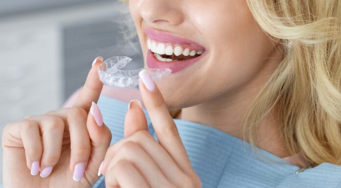 Tipos de ortodoncia: Descubre cuál es la mejor para ti Tipos de ortodoncia: Descubre cuál es la mejor para ti