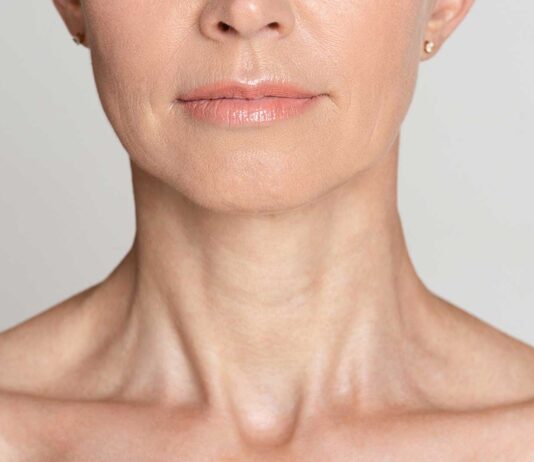 ¿Qué es la flacidez facial y cómo evitarla? flacidez facial