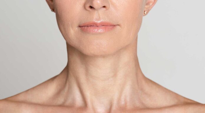 ¿Qué es la flacidez facial y cómo evitarla? flacidez facial