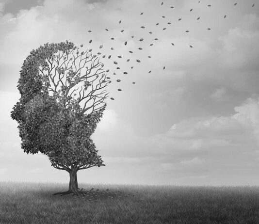¿Qué es y qué causa la Enfermedad del Alzheimer? enfermedad alzheimer