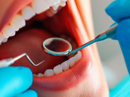 ¿Cuál es la importancia de las clínicas de salud dental y periodoncia? clinicas salud dental