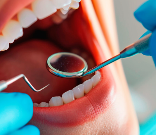 ¿Cuál es la importancia de las clínicas de salud dental y periodoncia? clinicas salud dental