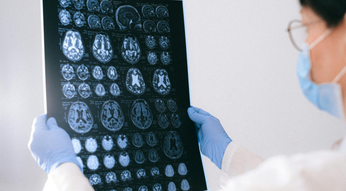 Enfermedades sistema nervioso central | Afecciones y prevención Enfermedades sistema nervioso central